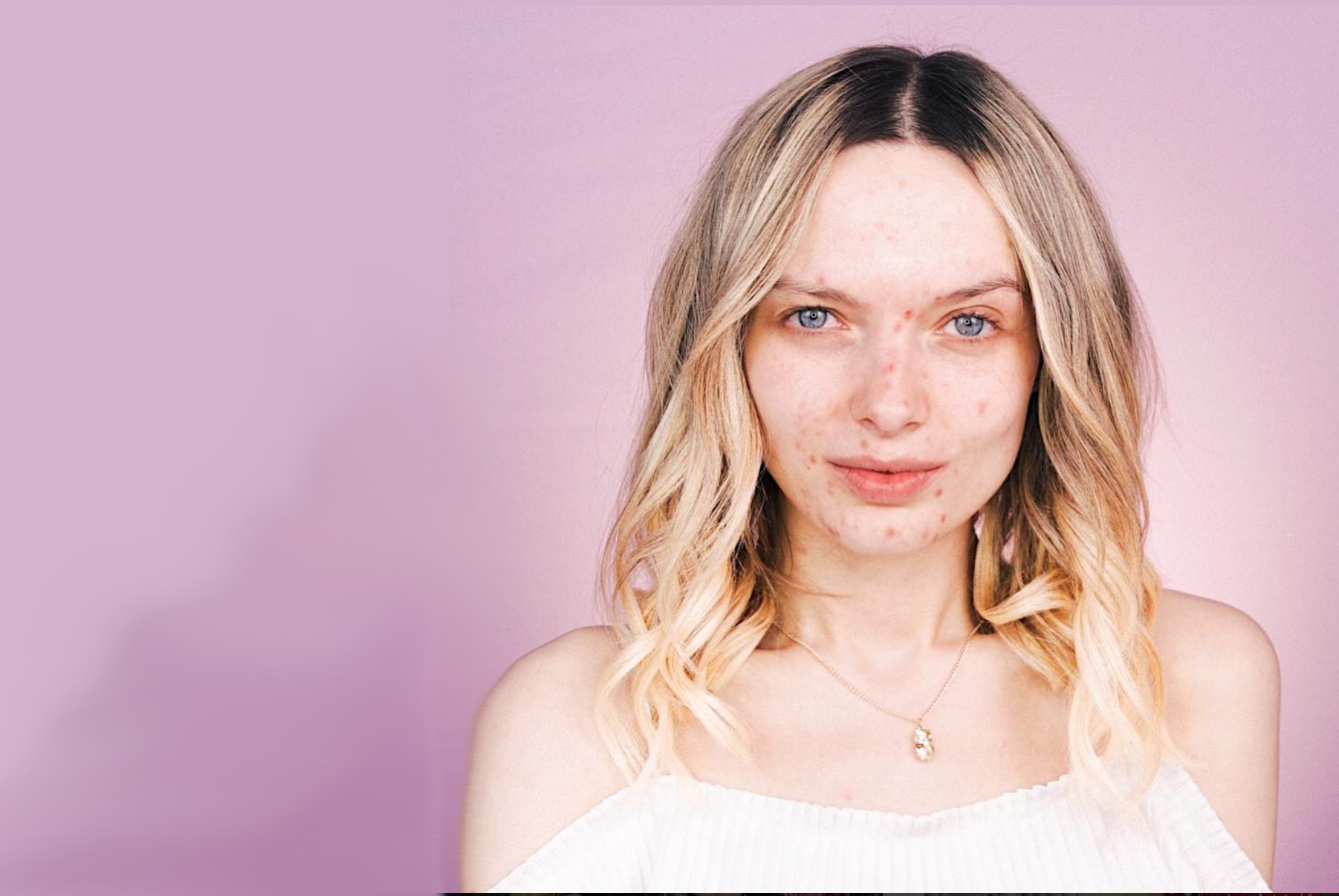 La piel perfecta ya no mola